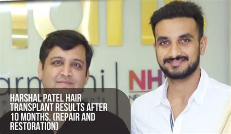 harshal patel hair transplant